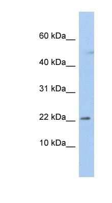 Western Blot: C19orf25 Antibody [NBP1-91526]