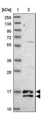 Western Blot: C19orf25 Antibody [NBP2-14391]