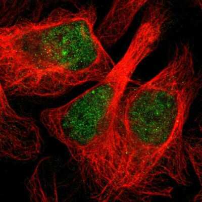 Immunocytochemistry/ Immunofluorescence: CBARP Antibody [NBP2-47534]