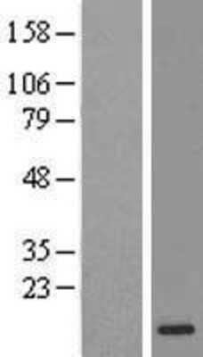 Western Blot: IMUP Overexpression Lysate [NBL1-08268]