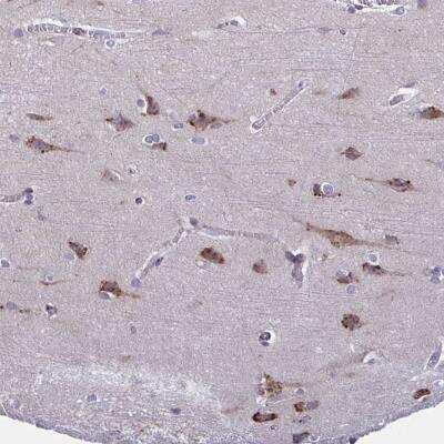 Immunohistochemistry-Paraffin: PEAK3 Antibody [NBP2-48720]