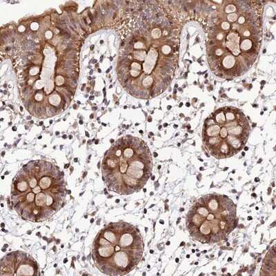 Immunohistochemistry-Paraffin: SMIM7 Antibody [NBP1-93497]