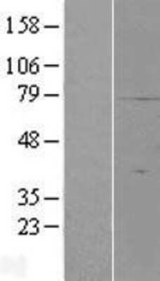 Western Blot: SMIM7 Overexpression Lysate [NBP2-06345]