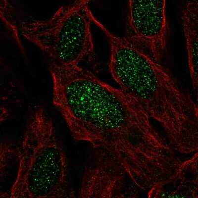 Immunocytochemistry/ Immunofluorescence: C19orf44 Antibody [NBP2-58435]