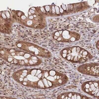 Immunohistochemistry-Paraffin: C19orf44 Antibody [NBP1-93950]