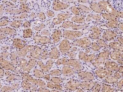Immunohistochemistry-Paraffin: C19orf44 Antibody [NBP2-98139]