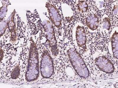 Immunohistochemistry-Paraffin: C19orf44 Antibody [NBP2-98139]