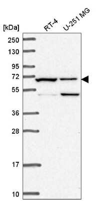 Western Blot: C19orf44 Antibody [NBP2-58435]