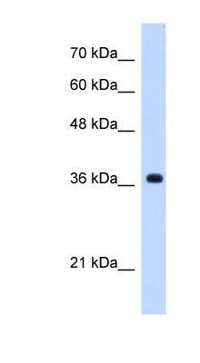 Western Blot: C19orf47 Antibody [NBP1-70445]