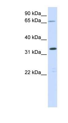 Western Blot: C19orf47 Antibody [NBP1-70446]