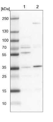 Western Blot: C19orf47 Antibody [NBP1-91722]