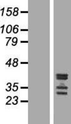 Western Blot: C19orf47 Overexpression Lysate [NBP2-04945]