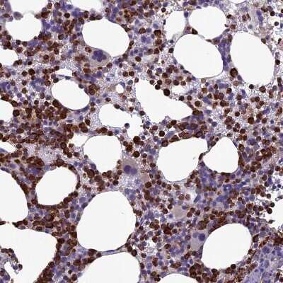 Immunohistochemistry-Paraffin: C19orf48 Antibody [NBP1-81210]