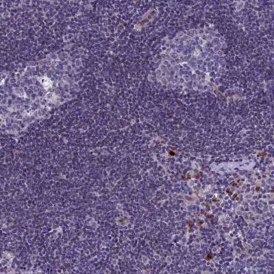 Immunohistochemistry-Paraffin: C19orf48 Antibody [NBP1-81210]