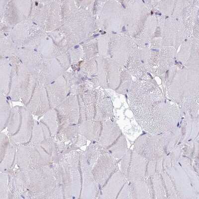 Immunohistochemistry-Paraffin: C19orf48 Antibody [NBP1-81210]