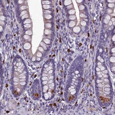 Immunohistochemistry-Paraffin: C19orf48 Antibody [NBP1-81210]