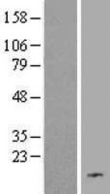 Western Blot: C19orf48 Overexpression Lysate [NBL1-08273]