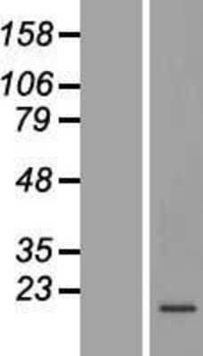 Western Blot: C19orf48 Overexpression Lysate [NBL1-08274]