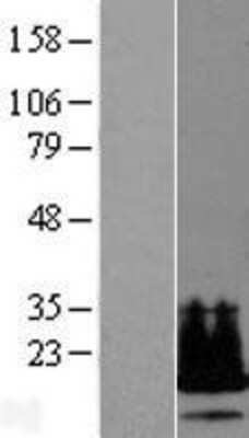 Western Blot: LYDG10 Overexpression Lysate [NBL1-08277]