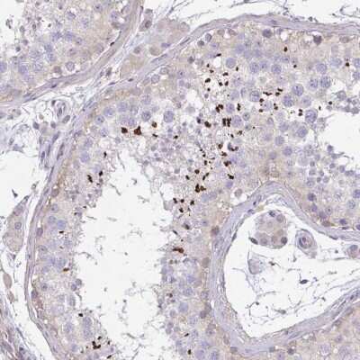 Immunohistochemistry: C19orf54 Antibody [NBP2-32485]