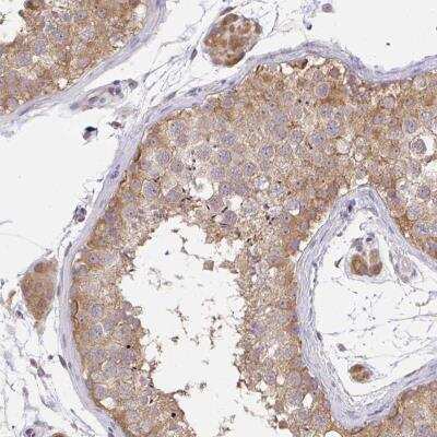 Immunohistochemistry-Paraffin: C19orf54 Antibody [NBP2-32418]
