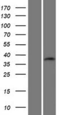 Western Blot: C19orf54 Overexpression Lysate [NBP2-04694]