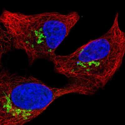 Immunocytochemistry/ Immunofluorescence: PROSER3 Antibody [NBP2-30902]