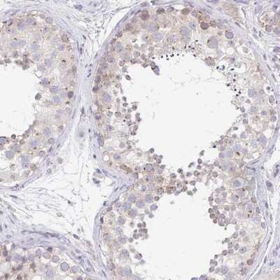 Immunohistochemistry-Paraffin: PROSER3 Antibody [NBP2-30902]