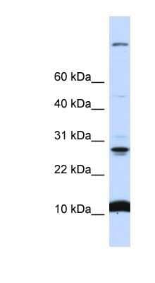 Western Blot: WDR83OS Antibody [NBP1-59969]