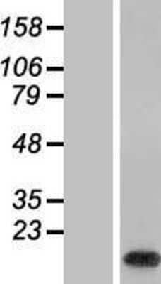 Western Blot: WDR83OS Overexpression Lysate [NBL1-08279]