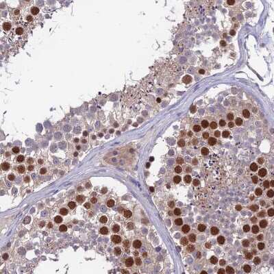 Immunohistochemistry-Paraffin: C19orf57 Antibody [NBP1-93524]