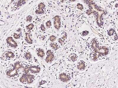 Immunohistochemistry-Paraffin: C19orf57 Antibody [NBP2-97388]