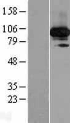 Western Blot: C19orf57 Overexpression Lysate [NBP2-06337]