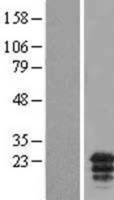 Western Blot: MCEMP1 Overexpression Lysate [NBL1-08280]