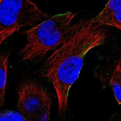 Immunocytochemistry/ Immunofluorescence: REX1BD Antibody [NBP1-93964]