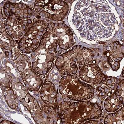 Immunohistochemistry-Paraffin: REX1BD Antibody [NBP1-93964]