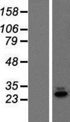 Western Blot: REX1BD Overexpression Lysate [NBP2-08253]