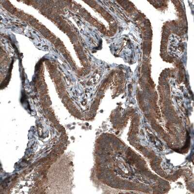 Immunohistochemistry-Paraffin: RyDEN Antibody [NBP1-90417]