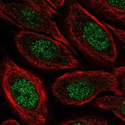 Immunocytochemistry/ Immunofluorescence: ZSWIM9 Antibody [NBP2-32584]