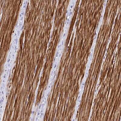 Immunohistochemistry-Paraffin: ZSWIM9 Antibody [NBP2-32584]