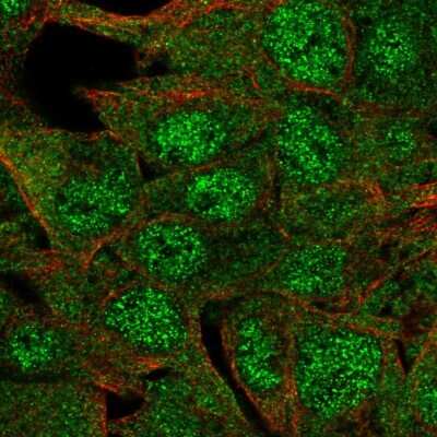 Immunocytochemistry/ Immunofluorescence: Glutamate Rich 4 Antibody [NBP2-30800]