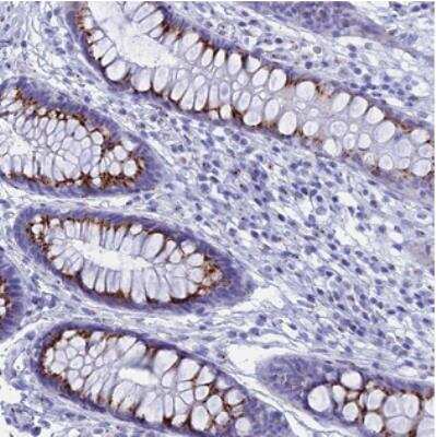 Immunohistochemistry: Glutamate Rich 4 Antibody [NBP2-30986]