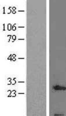 Western Blot: QIL1 Overexpression Lysate [NBL1-14028]