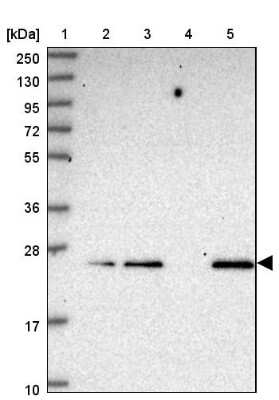 Western Blot: C19orf71 Antibody [NBP2-14650]