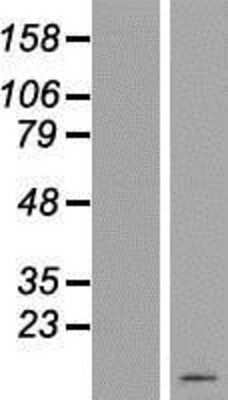 Western Blot: C19orf73 Overexpression Lysate [NBL1-10749]