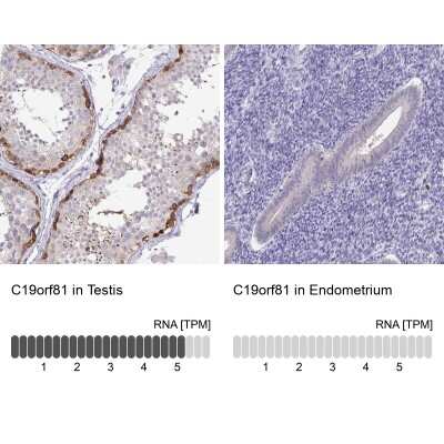 Immunohistochemistry-Paraffin: C19orf81 Antibody [NBP2-32518]