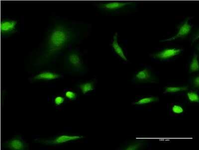 Immunocytochemistry/ Immunofluorescence: C1D Antibody (4H5) [H00010438-M10]