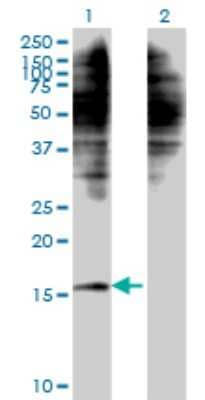 Western Blot: C1D Antibody (4H5) [H00010438-M10]