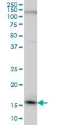 Western Blot: C1D Antibody (6H2) [H00010438-M03]