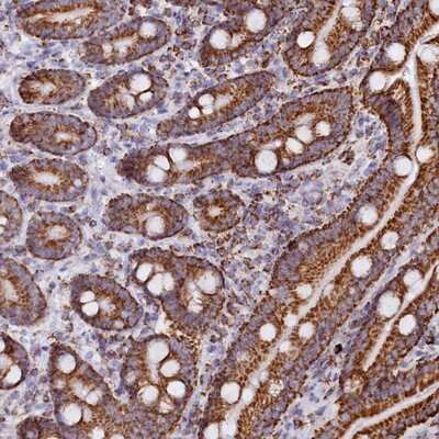 Immunohistochemistry-Paraffin: C1D Antibody [NBP1-81287]